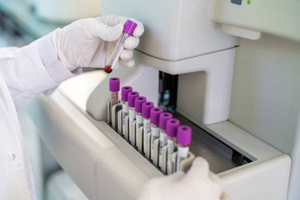 Purple laboratory vials